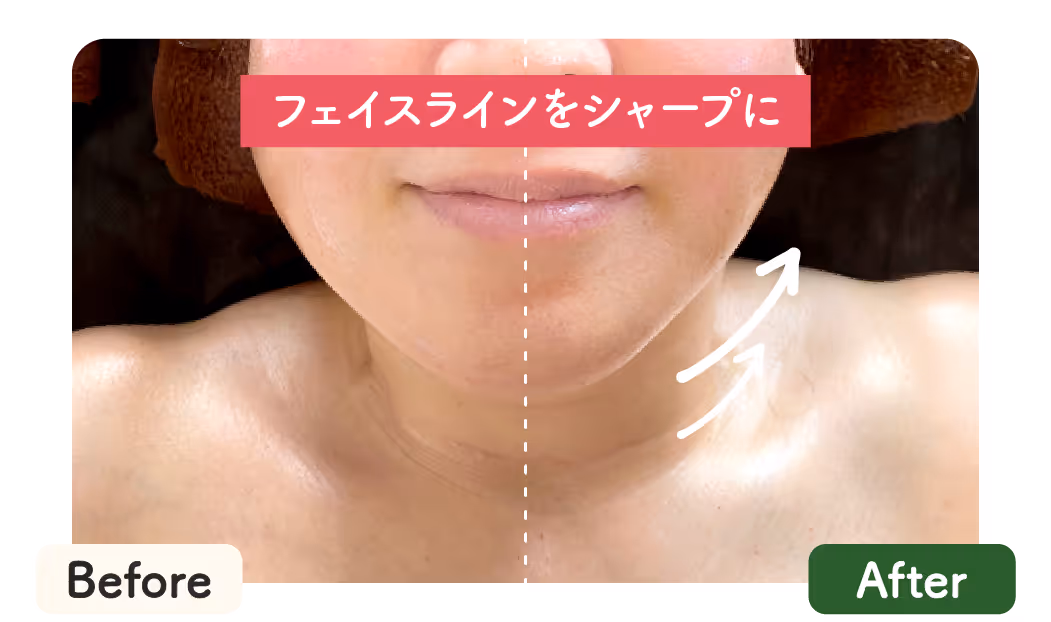 ベルジュールひたちなかのフェイシャルケア